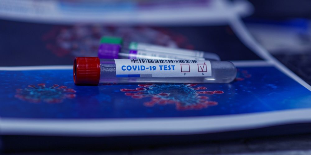 covid-19 test tube