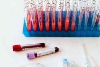 COVID blood test vials